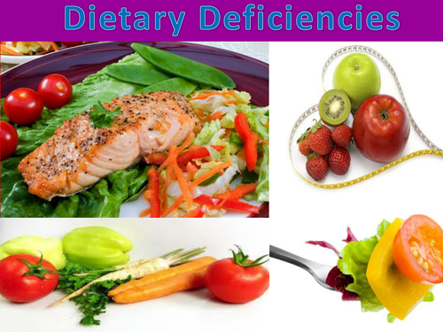 Dietary deficiency diseases: Presentation and activities for GCSE, A Level & similar Biology courses