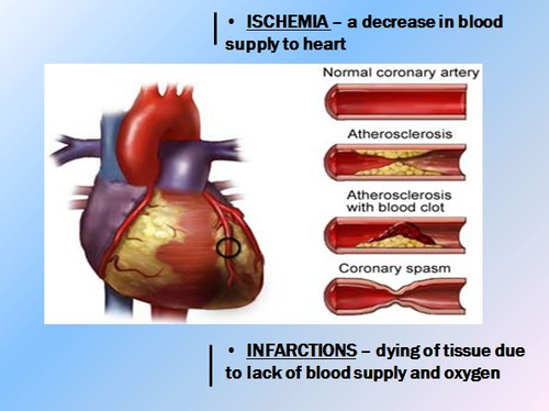 Cardiovascular System Unit (Circulatory System) Bundle | Teaching Resources