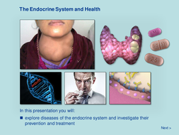 The Endocrine System and Health | Teaching Resources