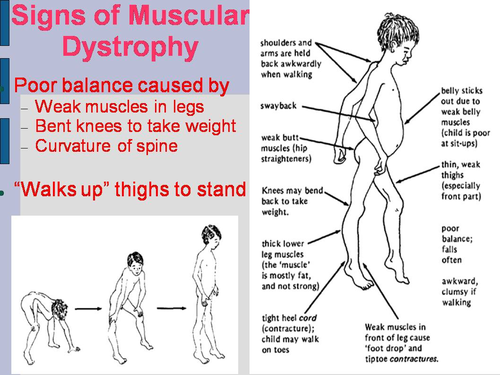 Muscle Pathology PowerPoint