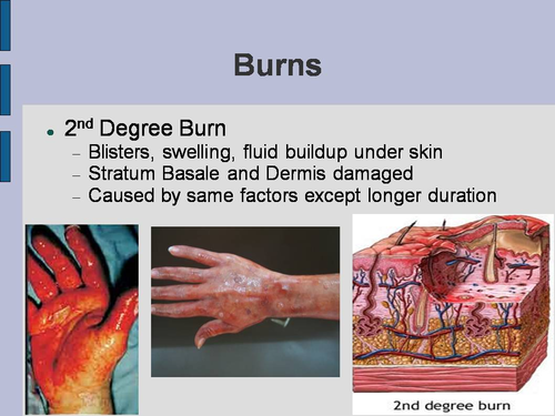 Burns and Skin Pathology PowerPoint