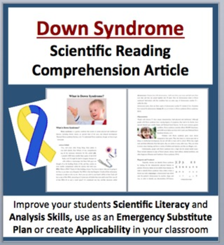 Down Syndrome Research Topics _ Down Syndrome: 10 Facts You Should Know ...