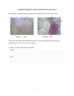 Osmosis, Turgidity And Plasmolysis In Plant Cells 