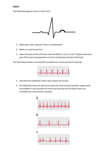 ECG plenary/review/recap