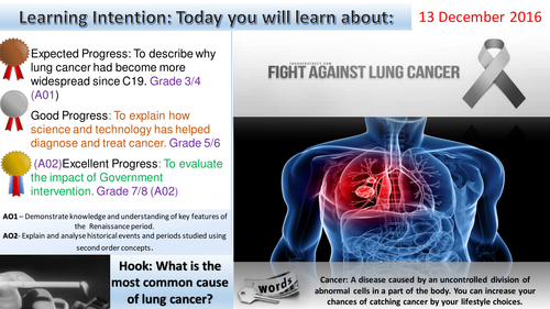 Medicine Through Time:  The Fight Against Lung Cancer. (Edexcel 1-9)