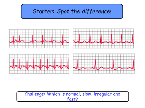 7.5 The cardiac cycle NEW Year 12 Biology specification