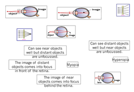 AQA GCSE Biology 9-1 (2016) The Eye | Teaching Resources