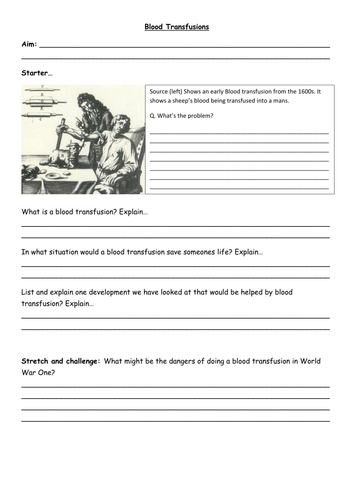 New - GCSE Edexel - Modern Medicine - Chapter 4 - Blood Transfusions