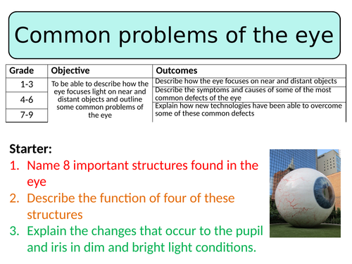 NEW AQA GCSE Biology (2016) - Common problems of the eye HT