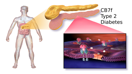 CB7f Type 2 diabetes
