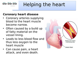 Topic 2 Cardiovascular Disease AQA trilogy | Teaching Resources