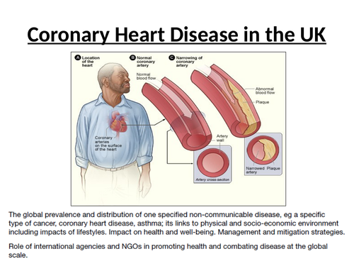 CHD in the UK and Europe