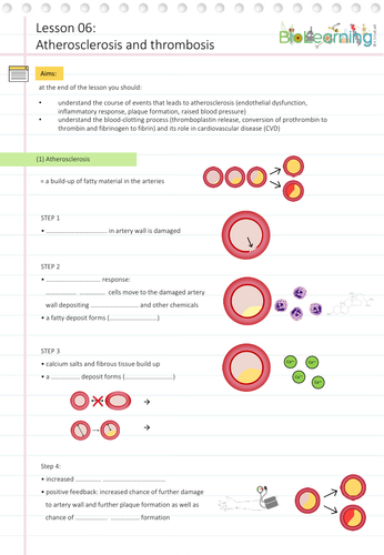 Snab Biology Topic 1 Lesson 6 Atherosclerosis And Thrombosis Ws