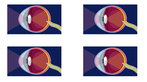 Light (Year 6) - 5 Lessons | Teaching Resources