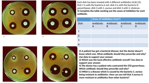 calculating-zones-of-inhibitions-teaching-resources