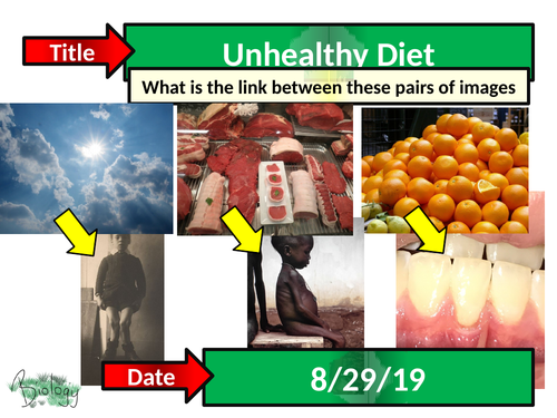 Unhealthy Diet - Activate