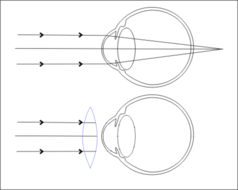 AQA B5 revision The Eye and Reflex Arc | Teaching Resources