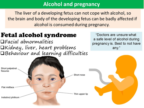 Alcohol and other Carcinogens | Teaching Resources