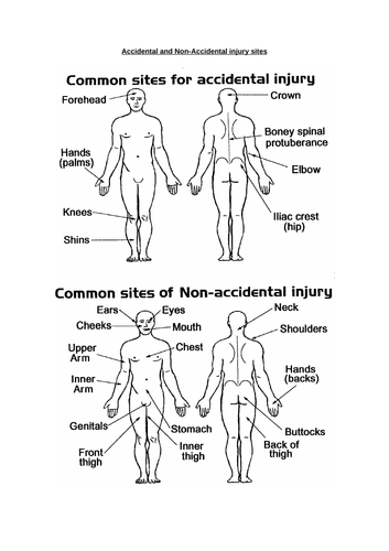 safeguarding-accidental-and-non-accidental-injury-sites-teaching