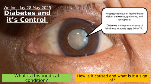 16.4 Diabetes & its Control