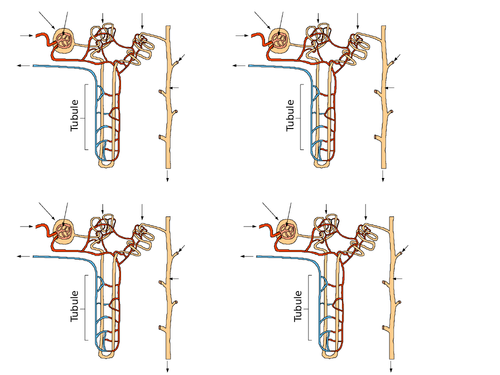 AQA GCSE Biology (9-1) B12.3 The human kidney FULL LESSON