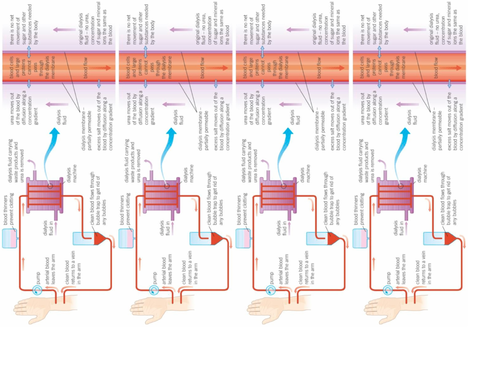 AQA GCSE Biology (9-1) B12.4 Dialysis - an artificial kidney FULL LESSON