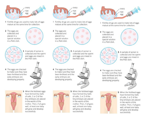 AQA GCSE Biology (9-1) B11.8 Infertility treatments FULL LESSON