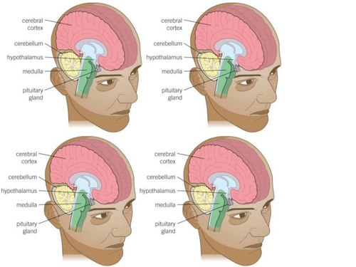 AQA GCSE Biology (9-1) B10.4 The brain FULL LESSON