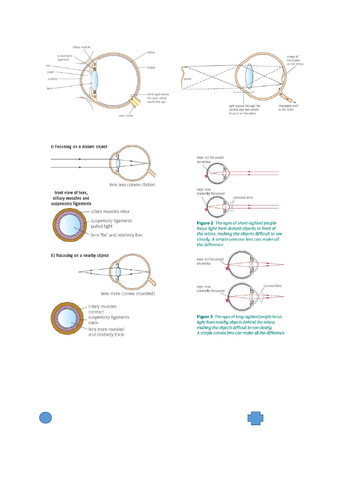 AQA GCSE Biology (9-1) B10.6 Common problems of the eye FULL LESSON