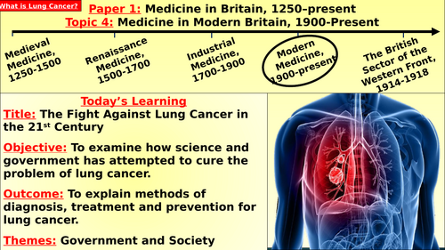 Edexcel Medicine – T4, L4: Lung Cancer (Modern Medicine)