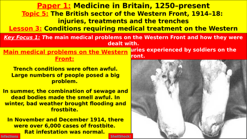 Edexcel GCSE History: The British Sector of the Western Front, L3 - Conditions Requiring Treatment