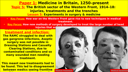 Edexcel GCSE History: The British Sector of the Western Front, L5 - Experiments Surgery & Medicine