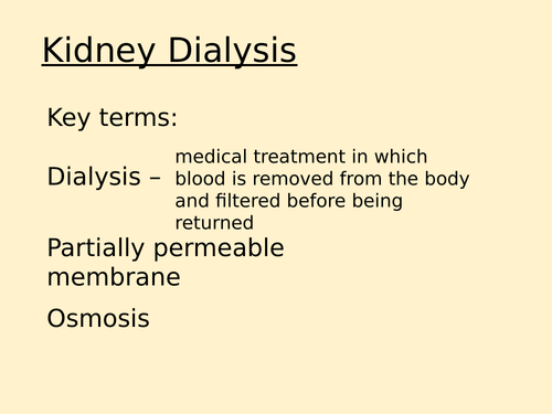 Kidney Dialysis & Kidney Transplants