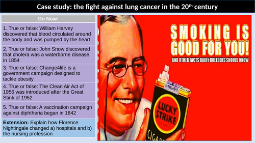 Medicine in modern Britain lung cancer