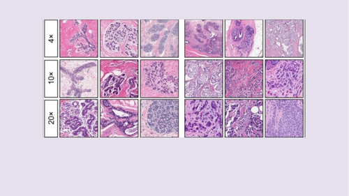 Gene Expression | Teaching Resources