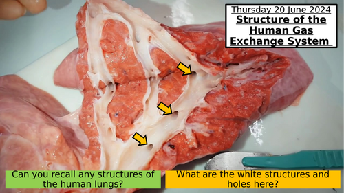 6.6 Structure of the Human Gas-Exchange System