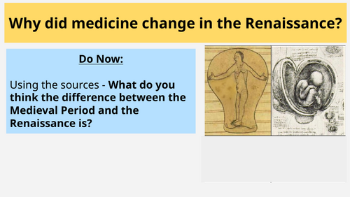 AQA Health & the People / Medicine / 4. Renaissance