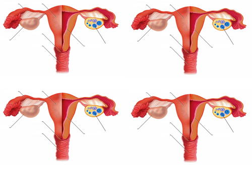 Female reproductive system Teaching Resources