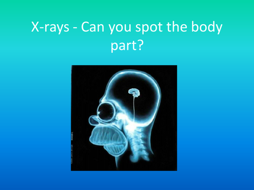 x rays teaching resources