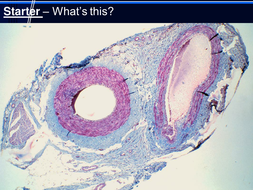 Case study practice - Heart disease | Teaching Resources