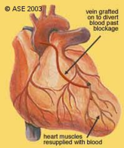 Heart Images | Teaching Resources