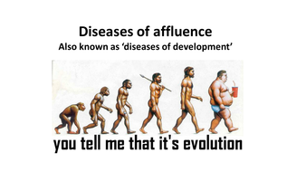 Diseases of affluence | Teaching Resources
