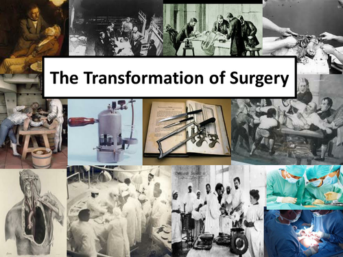 The Really Bloody History of Surgery | Teaching Resources